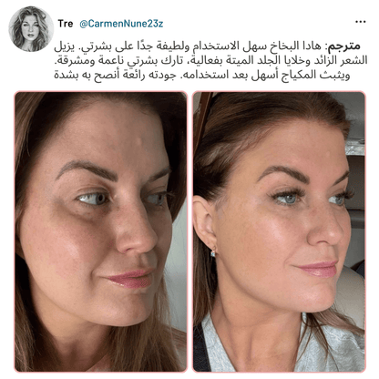 (Premium) Hair Identifier Spray (100 ML) & 4 blades