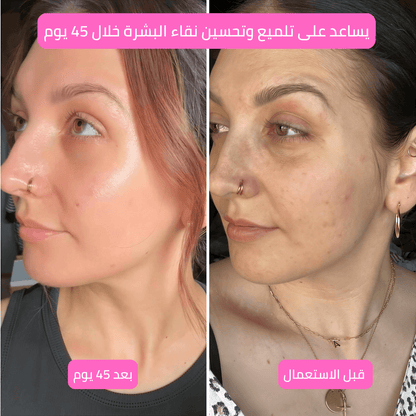 (Premium) Hair Identifier Spray (100 ML) & 4 blades