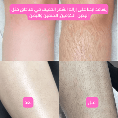 (Premium) Hair Identifier Spray (100 ML) & 4 blades