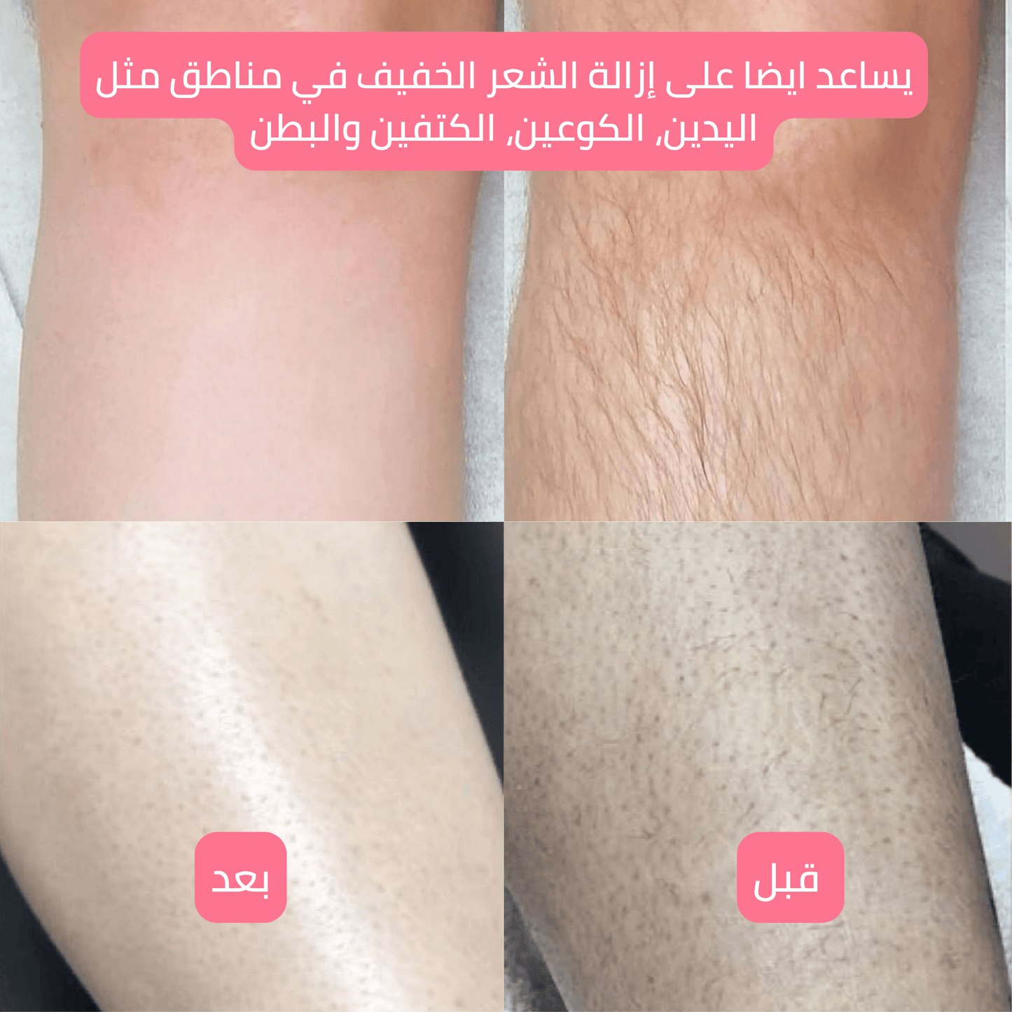 بخاخ تحديد الشعر (الاصلي)